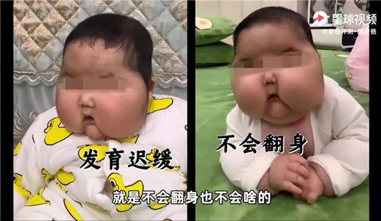 大头娃娃卷土重来深扒有毒儿童霜激素超标却有无数孩子在用